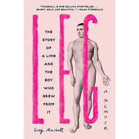 Leg: The Story of a Limb and the Boy Who Grew from It [Hardcover]