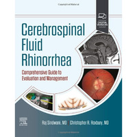Cerebrospinal Fluid Rhinorrhea: Comprehensive Guide to Evaluation and Management [Hardcover]