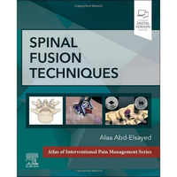Spinal Fusion Techniques [Hardcover]