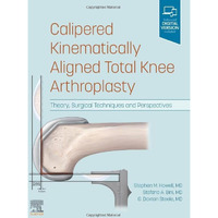 Calipered Kinematically aligned Total Knee Arthroplasty: Theory, Surgical Techni [Hardcover]