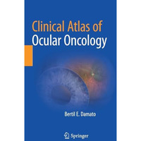 Clinical Atlas of Ocular Oncology [Paperback]
