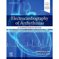 Electrocardiography of Arrhythmias: A Comprehensive Review [Paperback]