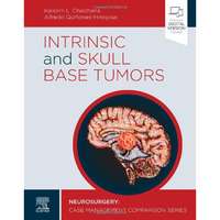 Intrinsic and Skull Base Tumors: Neurosurgery: Case Management Comparison Series [Hardcover]