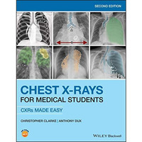 Chest X-Rays for Medical Students: CXRs Made Easy [Paperback]