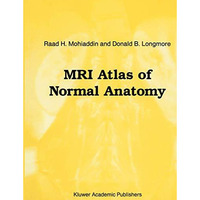MRI Atlas of Normal Anatomy [Paperback]