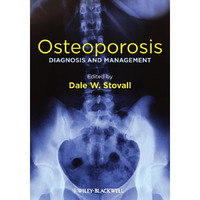 Osteoporosis: Diagnosis and Management [Hardcover]