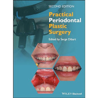 Practical Periodontal Plastic Surgery [Hardcover]