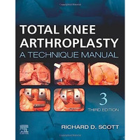 Total Knee Arthroplasty: A Technique Manual [Hardcover]