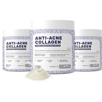 What's Up Wellness Anti-Acne Collagen|Certified Marine Titagen Collagen With Mangosteen & Biotin|Reduces Adult Acne|For Men & Women|Black Currant|Pack Of 3, Powder, 3 Count, 25 Servings