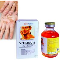 Vitiligo Cream To Care Ringworm White Spots, Tag Skin,Herbal Vitiligo Repair Gel With Organic Aloe Vera And Neem, Helps Fade Patches, Restores Natural Pigmentation Vitiligo Spot For Men & Women. 35Ml