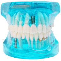 Identical All-In-One Implant & Restoration Model M2001  Blue | Comprehensive Dental Training Model For Implantology, Prosthetics & Restoration | Ideal For Study, Demonstration & Practice