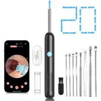 Ear Wax Removal Tool Camera, Ear Cleaner With Camera And 6 Led Light, 1080P Hd Ear Scope, Ear Cleaning Kit, 9 Ear Tools And 20 Ear Replacement Tips, For Ios & Android (Black)