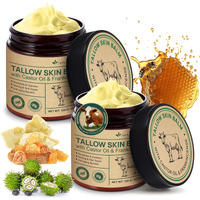 2 Pcak Beef Tallow Cream With Castor Oil And Frankincense, 100% Grass-Fed Tallow For Skin Care, Face & Body Moisturizer For Skin, Sensitive Skin & Dry Skin Age Defying, Eczema All-Purpose Balm