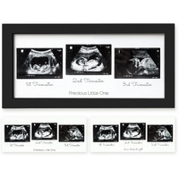 Sonogram Picture Frame - Trio Ultrasound Picture Frames For Mom To Be Gift - Baby Ultrasound Frame - Pregnancy Announcements Sonogram Frame - Baby Nursery Decor, Pregnant Mom Gifts (Onyx Black)
