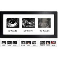 Iheipye Triple Sonogram Pregnancy Frame - Baby Ultrasound Picture Frame With Story For Expecting Parents, Baby Shower Frame, Baby Grow Through All Three Trimesters Frame, Nursery Decor, Black