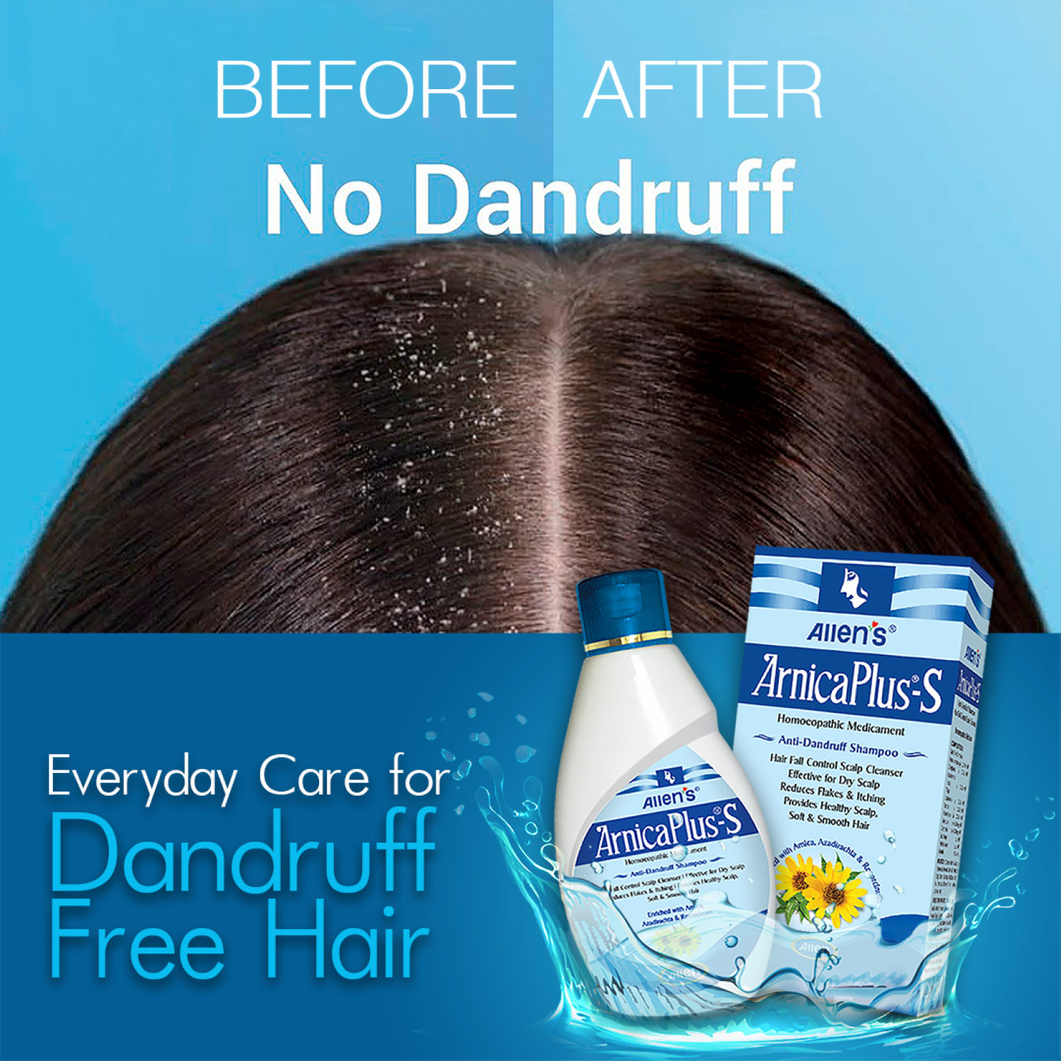 Allen Laboratories Arnica Plus S - Anti Dandruff Shampoo 100 ml (Pack of 2)