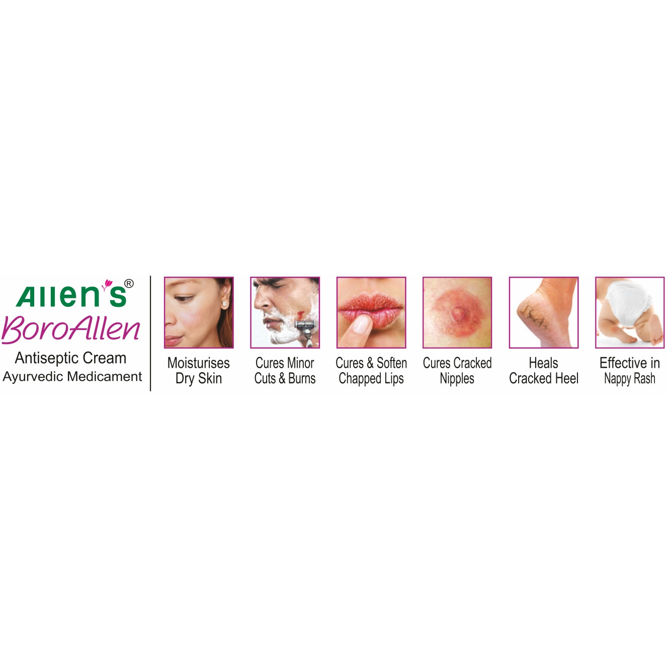 Allen Laboratories Boro Allen Anti Septic Cream 20 gm (Pack Of 4)
