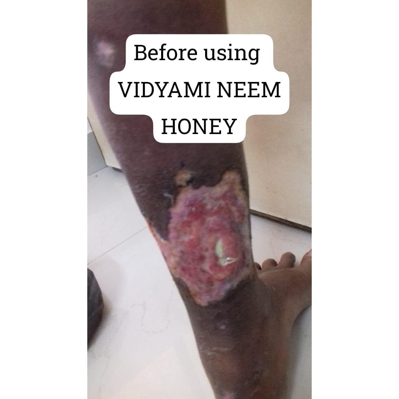 Vidyami Natural 100% Organic Pure Wild Forest Natural NEEM Honey Unprocessed Naturally Rich Active No Sugar Adulteration, Immunity Booster, 1Kg (1)