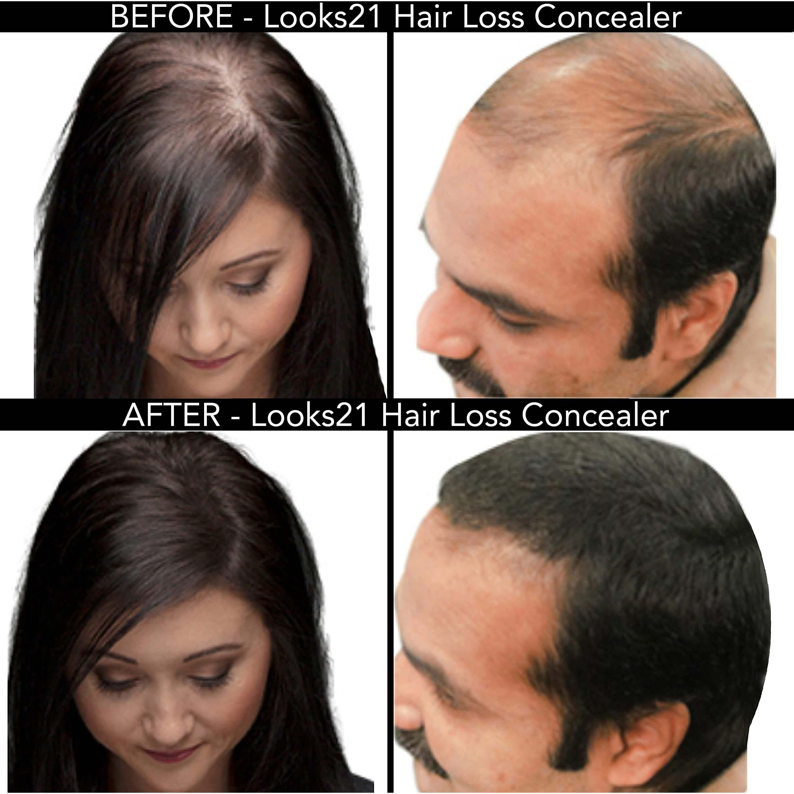 Looks21 Hair Loss Concealer (35Gm / 1.2Oz, Dark Brown)