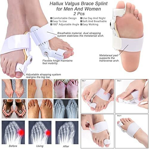 Shopibuy Foot Support For Pain Relief Toe Separator Orthotics Thumb Corrector For Care & Plastic Bunion Splint Pad, Toe Straightener Bunion Corrector Splint With Toe Fracture Support Tail