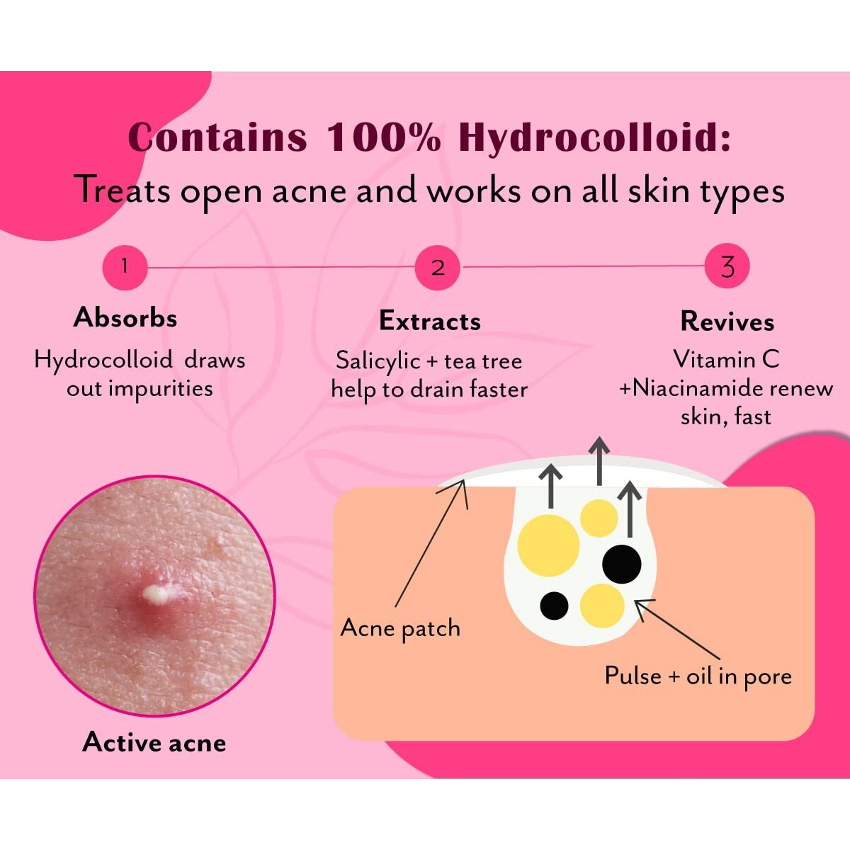 Urban Yog Acne Pimple Patch - Invisible Facial Stickers Cover With 100% Hydrocolloid, Pimple / Acne Absorbing Patch (Rectangular Pimple Patch) - Pack Of 1