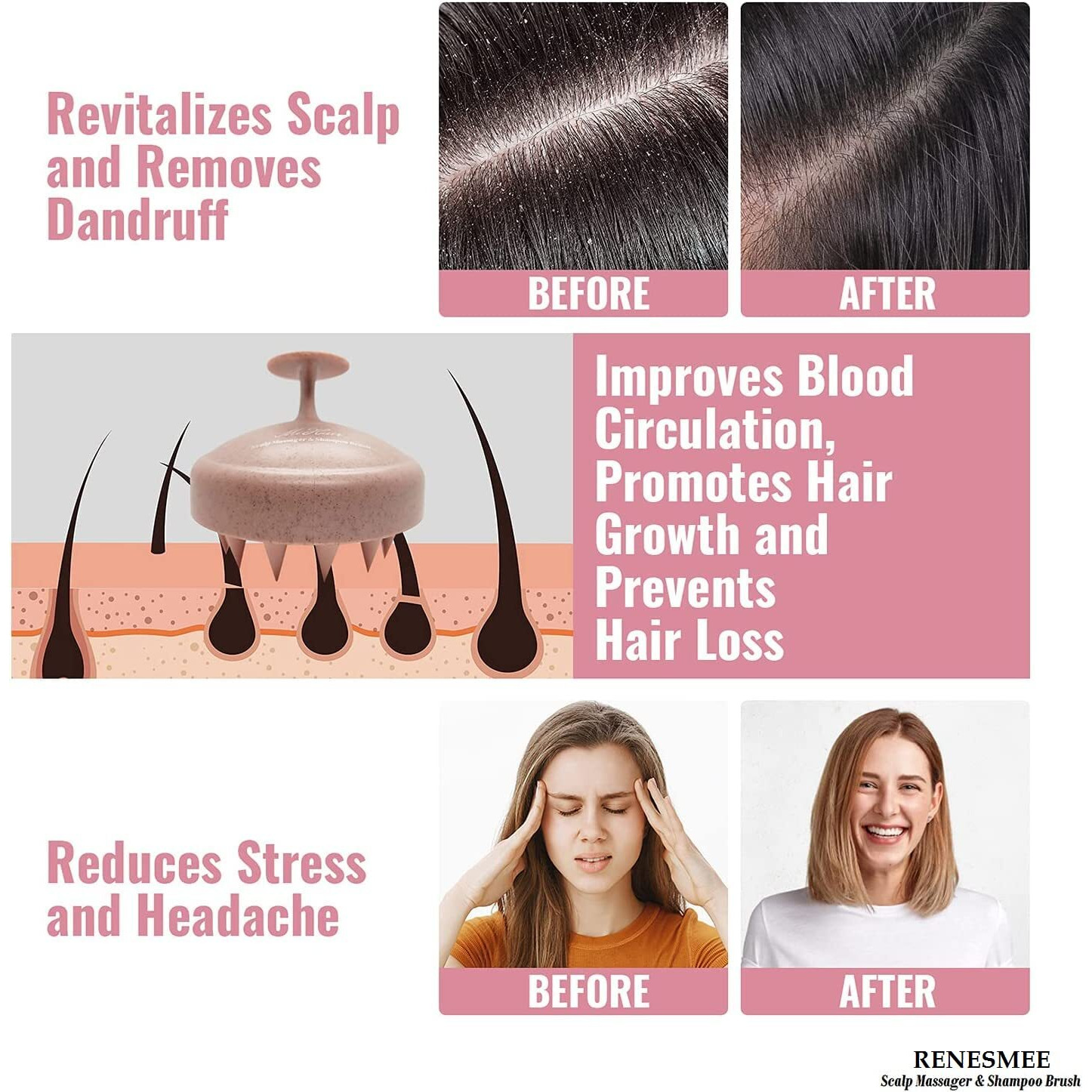 Renesmee Scalp Massager Shampoo Brush, Eco-Friendly Wheat Straw Body With Soft Silicon Bristles, Hair Scalp Scrubber, Scalp Exfoliator | Dandruff Removal, Prevents Hair Loss (Pink)