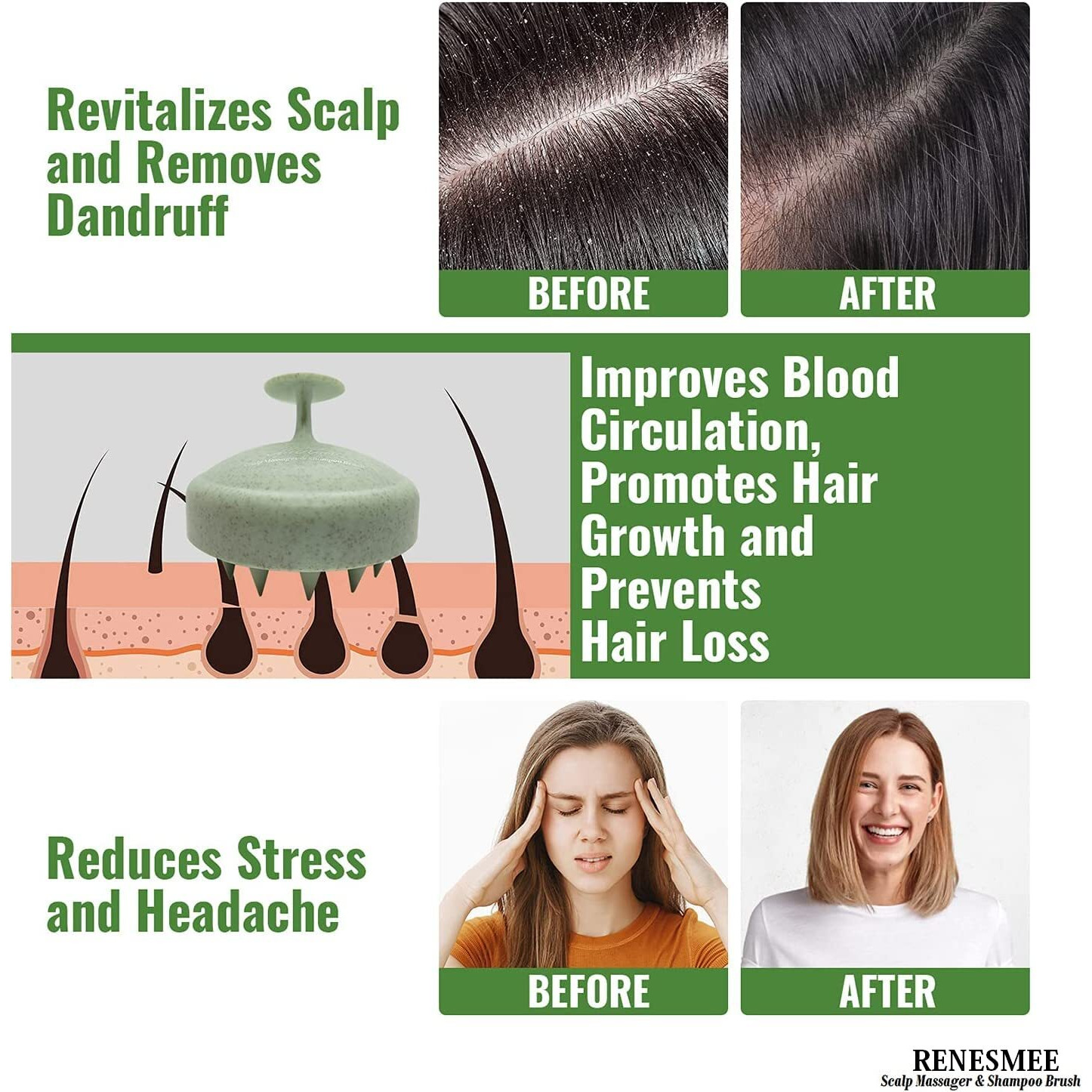 Renesmee Scalp Massager Shampoo Brush, Eco-Friendly Wheat Straw Body With Soft Silicon Bristles, Scrubber, Exfoliator | Dandruff Removal, Prevents Hair Loss For Men, Women (Green)
