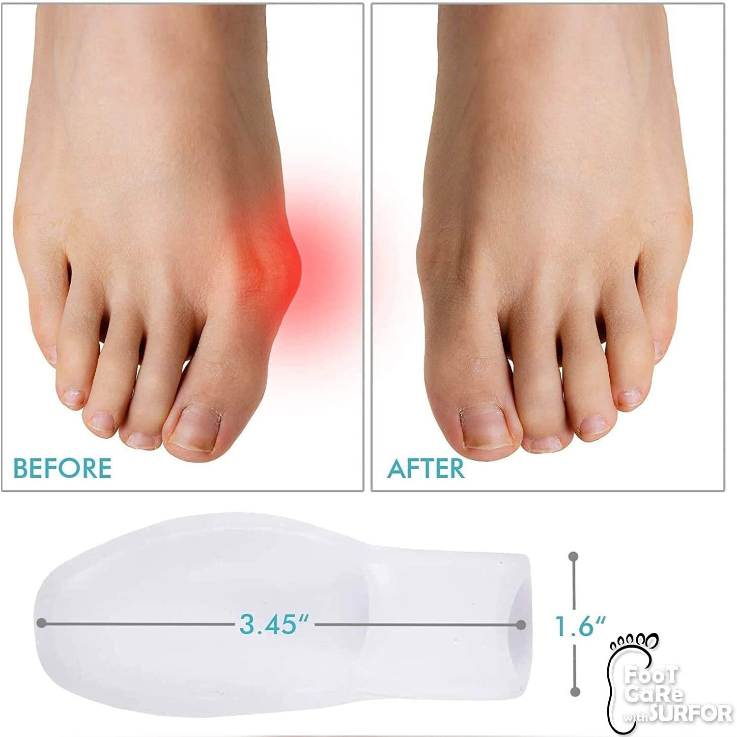 Toe Separator For Feet Toe Spacers Correct Toes Yoga Silicone Hammer Toe Corrector For Women & Men Correct Toe Straighteners For Overlapping Toes (Toe Separator)