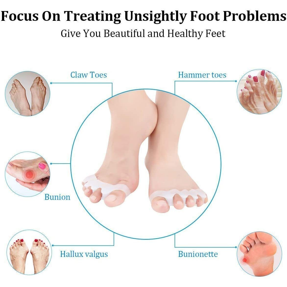 Suefor Silicone Gel Toe Separators, 5 Holes High Elastic Toe Straightener Hammer Hallux Valgus Corrector Pain Relief Toe Straightener Achilles Stretcher, Toe Spacers Bunion (White)