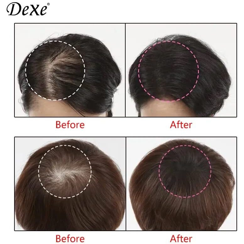 Eamaze Dexe Root Cover Up, 6Gm (Black) Instantly Cover Greys + Touch Up Highlights, Water-Sweat-Resistant Root Concealer (Black)