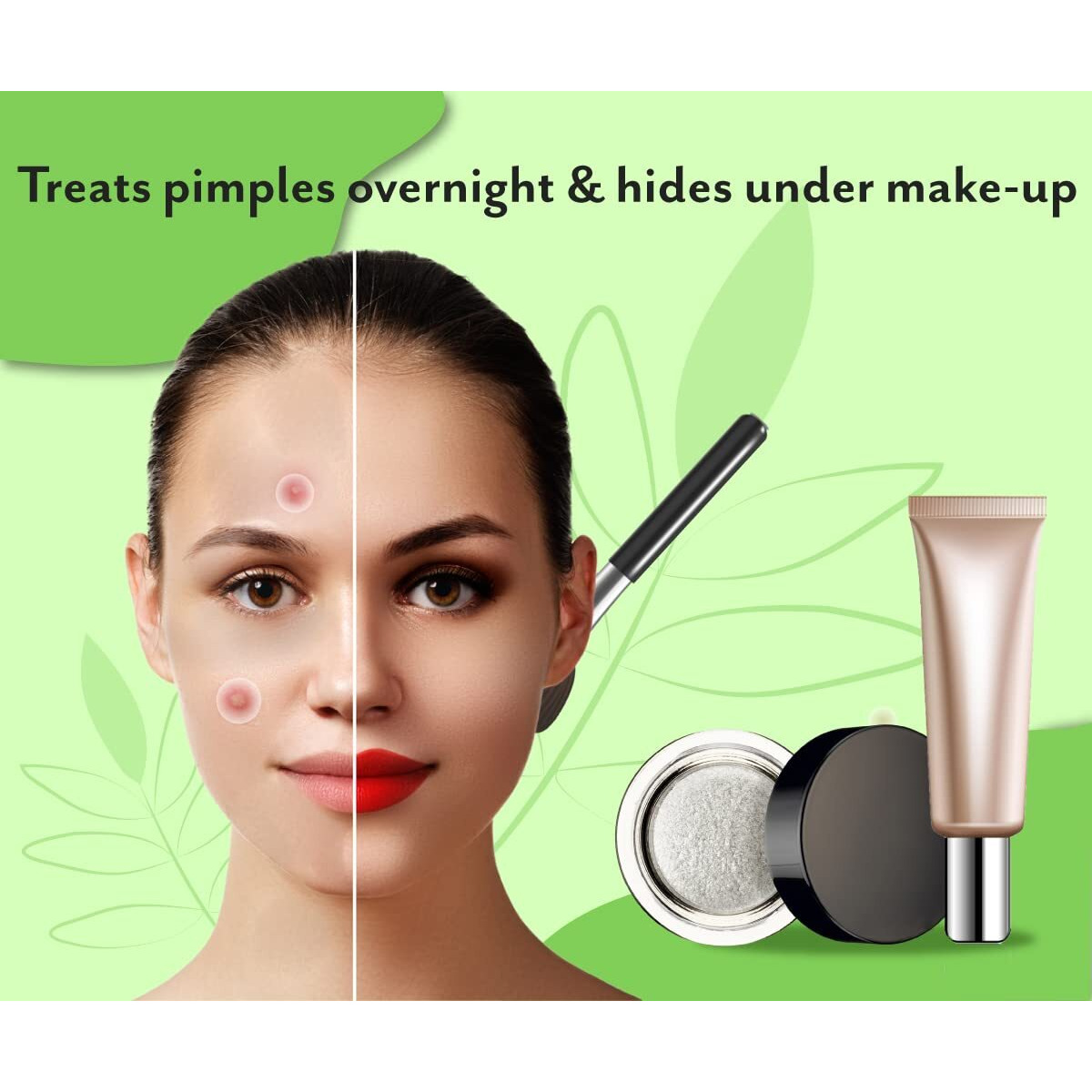 Urban Yog Acne Pimple Patch - 72 Invisible Facial Stickers Cover With 100% Hydrocolloid (Acne Pimple Patch (Pack Of 2))