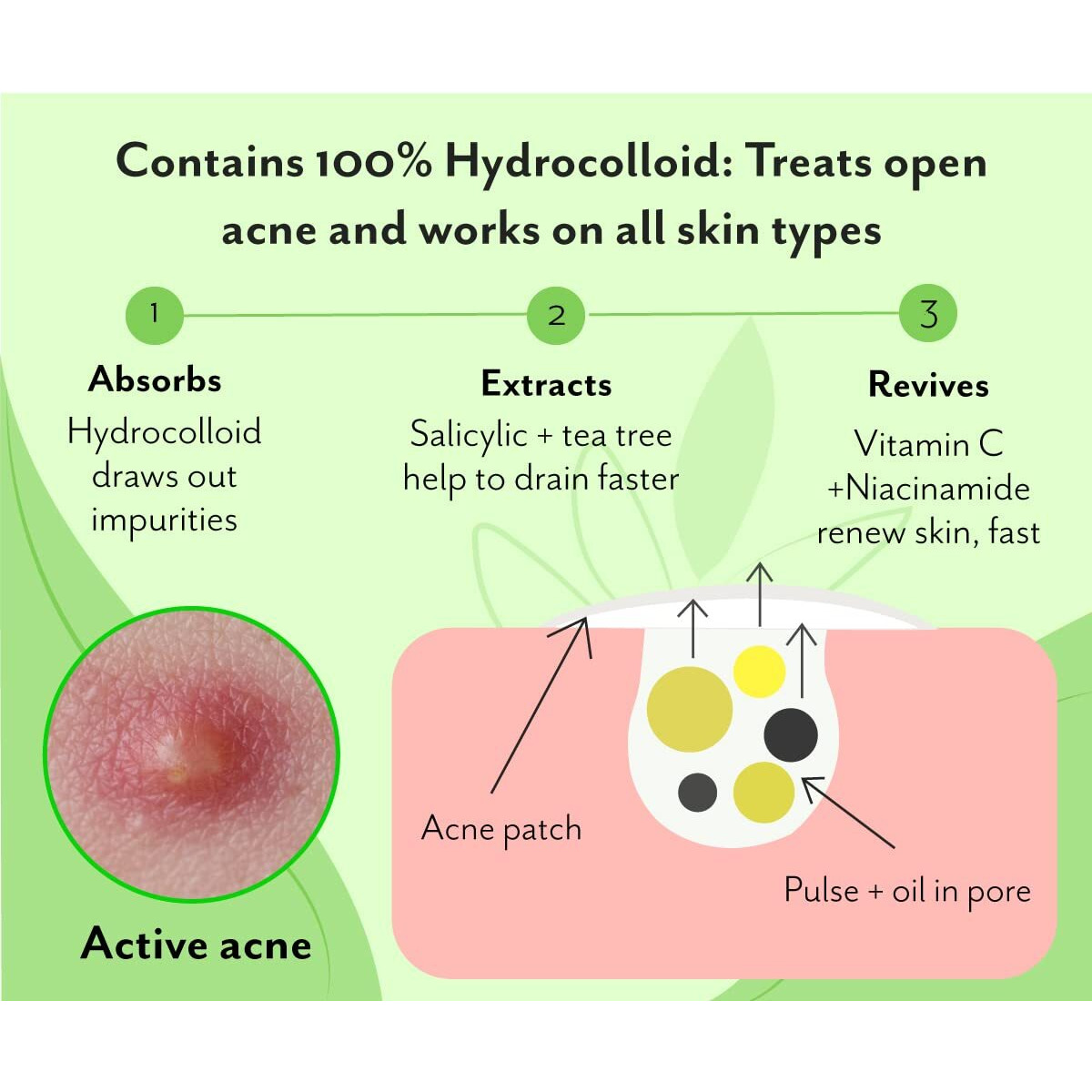Urban Yog Acne Pimple Patch - 72 Invisible Facial Stickers Cover With 100% Hydrocolloid (Acne Pimple Patch (Pack Of 2))