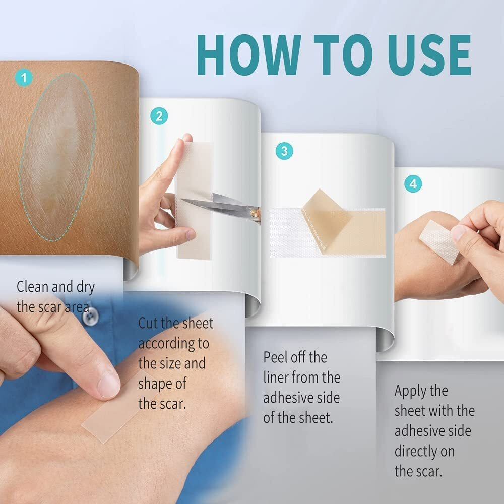 Gopinath Autolink Waterproof Silicone Reusable Scar Removal Sheets For Softening And Flattening Scars Soft Long Strips & Sheets Professional Strips Patches (8Pcs Scar Repair Sheets)