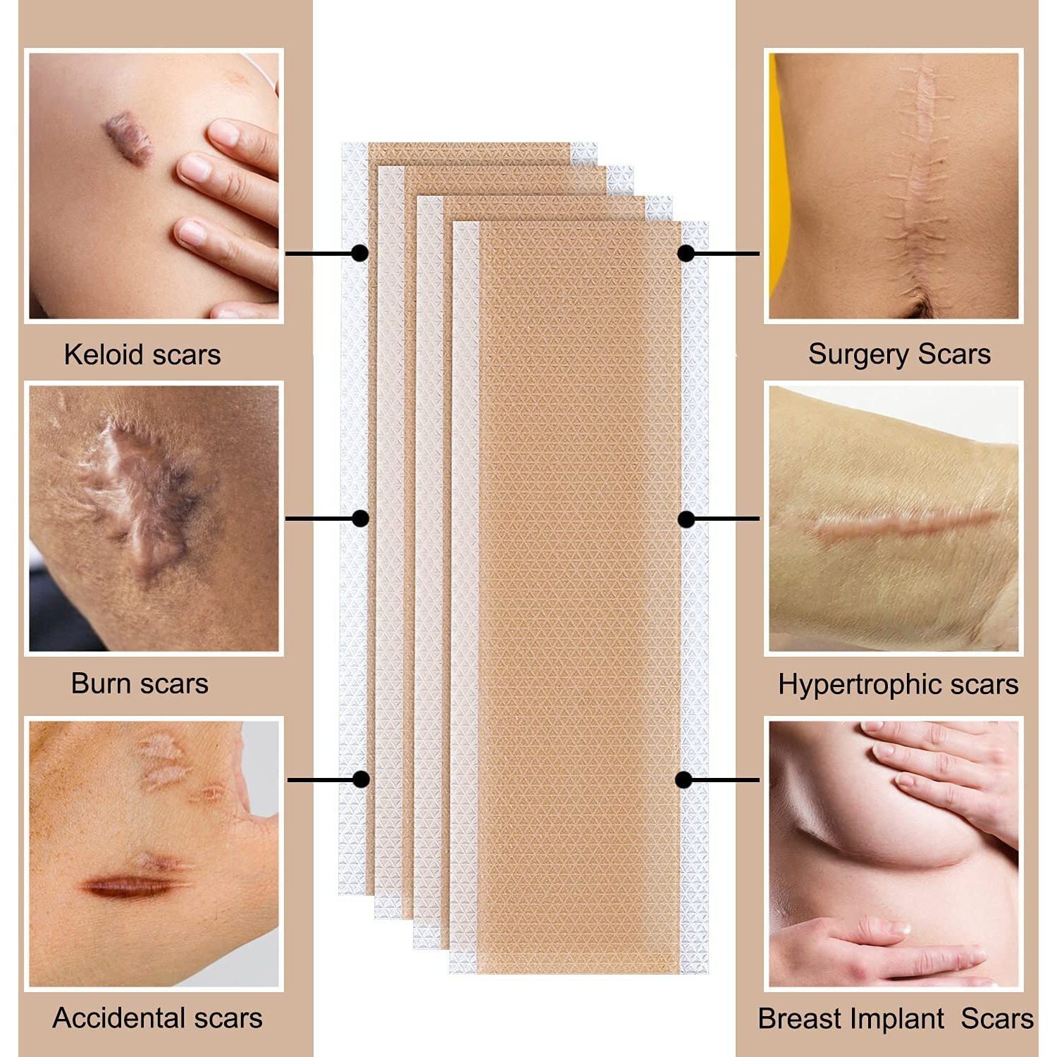 Gopinath Autolink Waterproof Silicone Reusable Scar Removal Sheets For Softening And Flattening Scars Soft Long Strips & Sheets Professional Strips Patches (8Pcs Scar Repair Sheets)