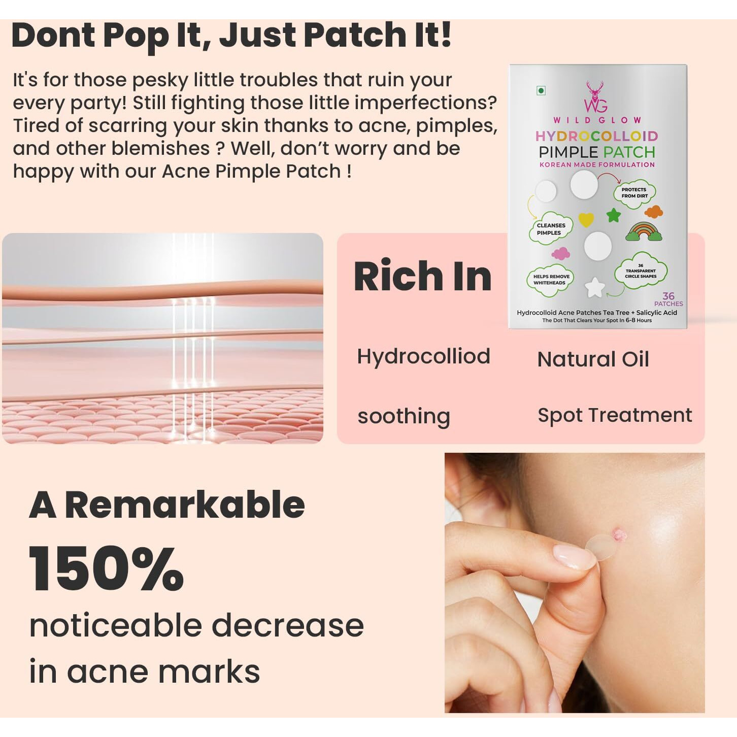 Wildglow Korean Hydrocolloid Overnight Acne Pimple Patch | Heal Pimples, Absorbs Pus-Oil, Reduces Redness | Enriched With 2% Salicylic Acid, Tea Tree Oil & Glycolic Acid | All Skin Types | 36 Patches