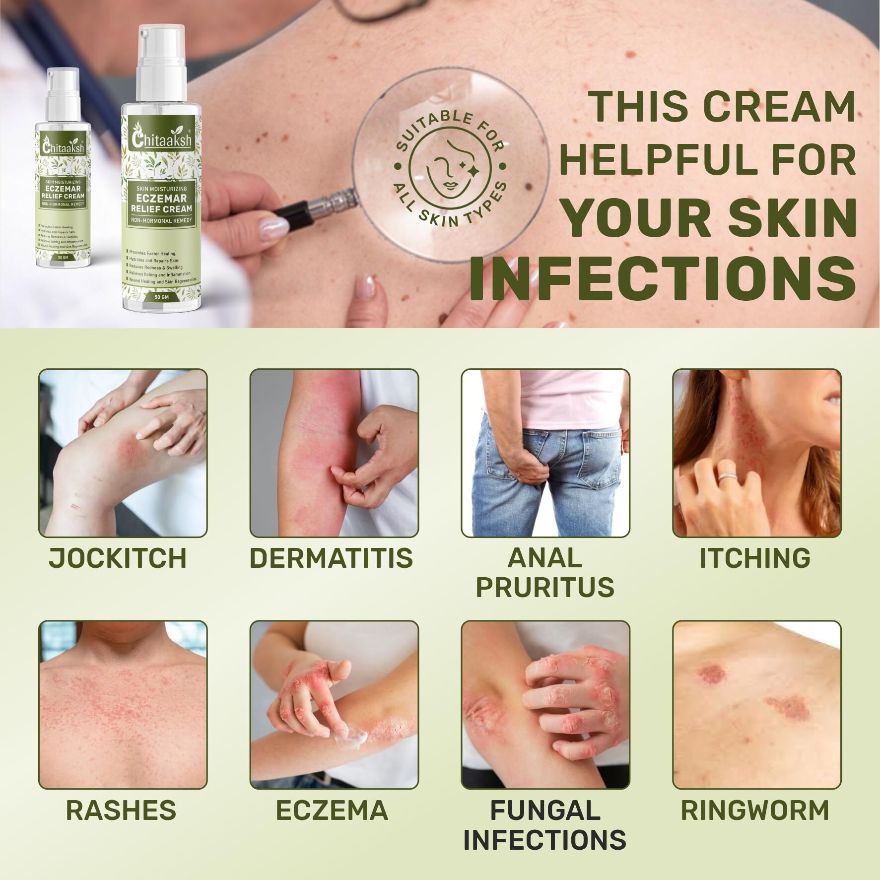 Chitaaksh Eczemaron Fungal Cream For Men & Women Ayurvedic Itchcoat Anti Fungal Malam For Ringworm Itching Eczema Cream For Face, Hand & Body (50 Gm)