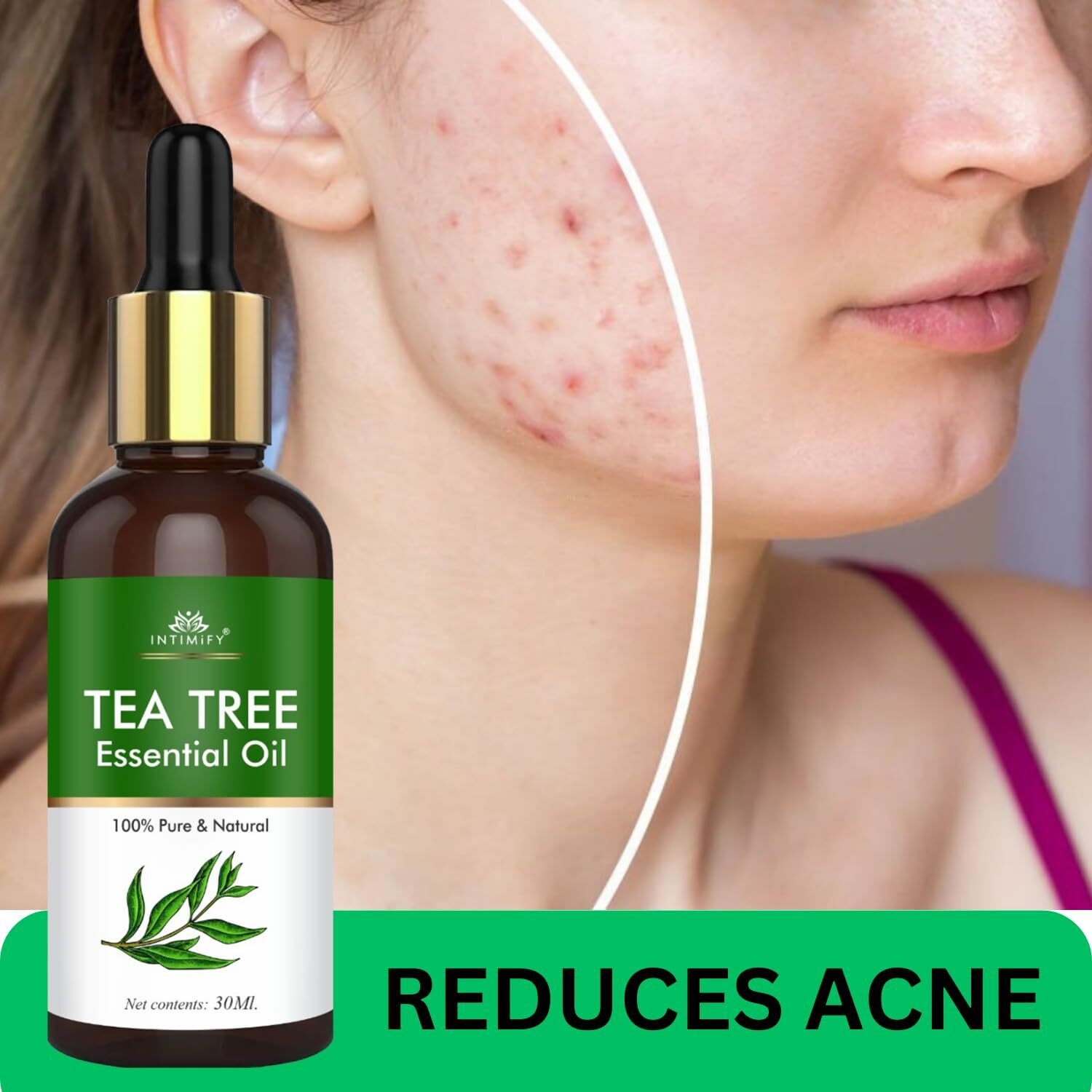 Intimify Tea Tree Essential Oil For Hair, Skin & Face Acne Care | Promote Hair Growth | Aromatherapy | Women & Men | 30 Ml (Pack Of 1)