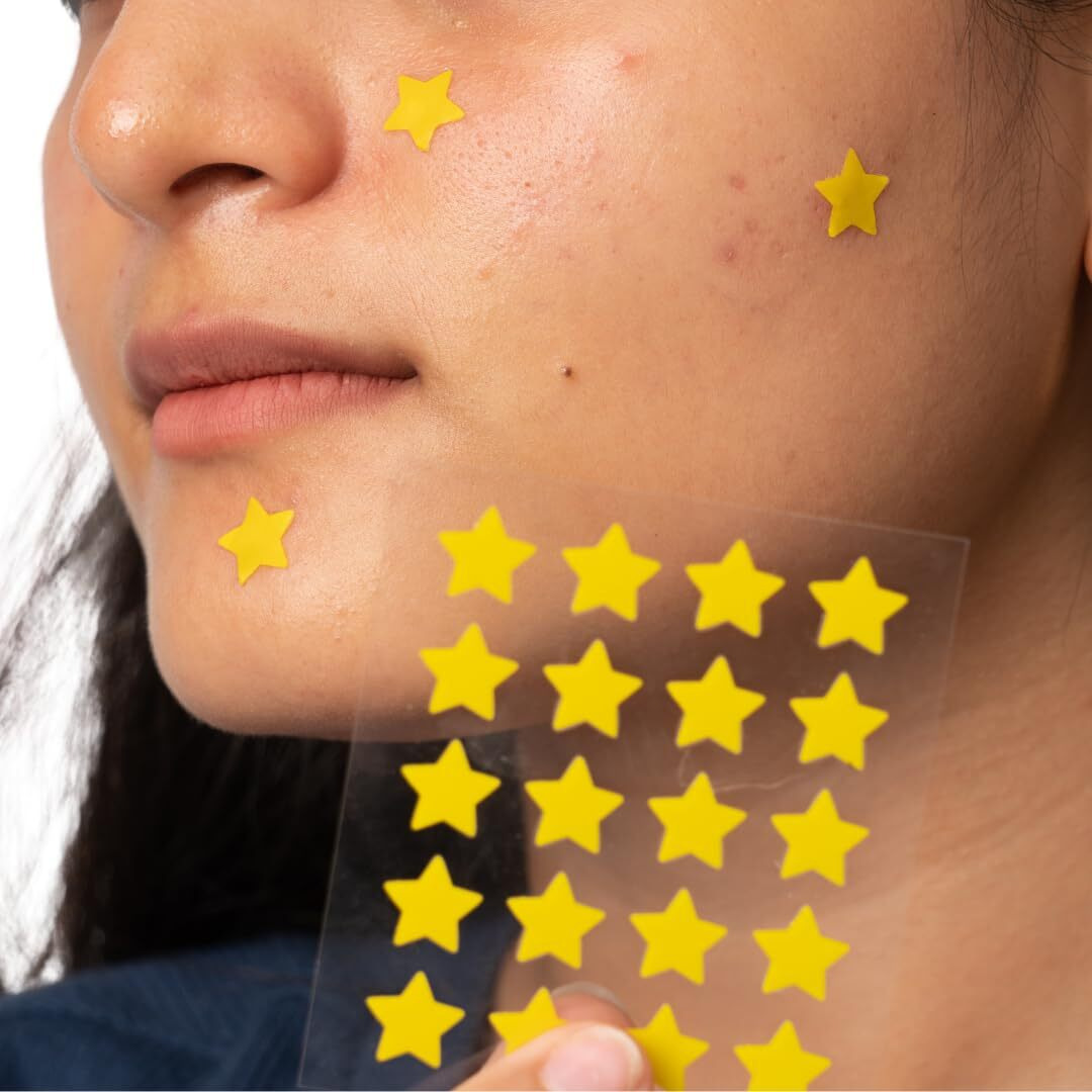 Gush Beauty Acne Pimple Patch | 20 Hydrocolloid Patches With Tea Tree Oil | Reduces Acne Pimples Excess Oil Overnight | For All Skin Types (Star 20 Count)