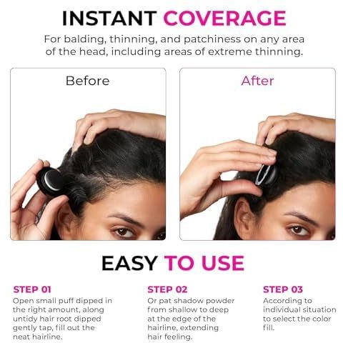 Etsap Cover-Up Hair Powder- Black, Helps Cover Grey Roots & Bald Spots Instantly, Highly Pigmented, Fuller And Denser, Long-Lasting & Matte Finish, Fine Powder For Flawless Application, 4Gm