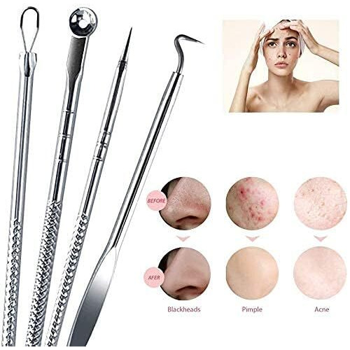 B-Bucket Etsap Stainless Steel Blackhead Remover Pimple Blemish Extractor Remover Tool Set Of 4