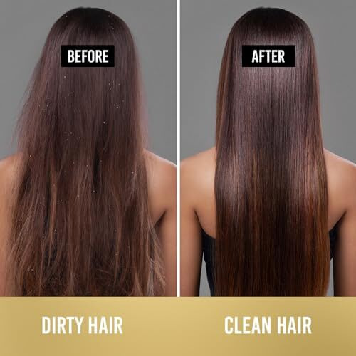 Pantene Advanced Hair Care Solution Lively Clean Shampoo, 200 Ml