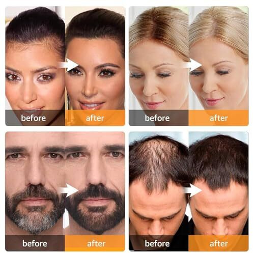 Natural Hairline Powder, Hair Shading Sponge Pen, Hairline Shadow Powder Stick, Quick Root Touch-Up Eyebrow Stamp Root Cover Up Eyebrow Stamp Root Cover Up Eyebrow Stamp Root Cover Up Root Touchup Hairline (Powerfull Model) (Black)