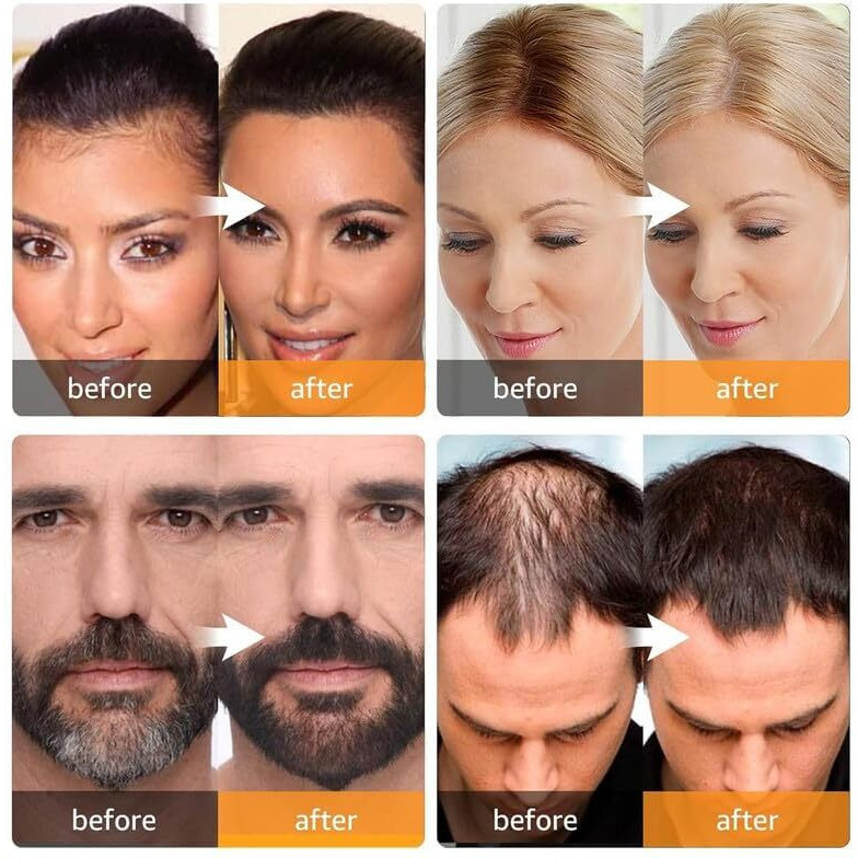 Hairline Powder,Natural Hairline Powder, Hair Shading Sponge Pen, Hairline Shadow Powder Stick, Quick Root Touch-Up Eyebrow Stamp Root Cover Up Hairline Powder Black Root Touchup,4Gm(Black, Standard)