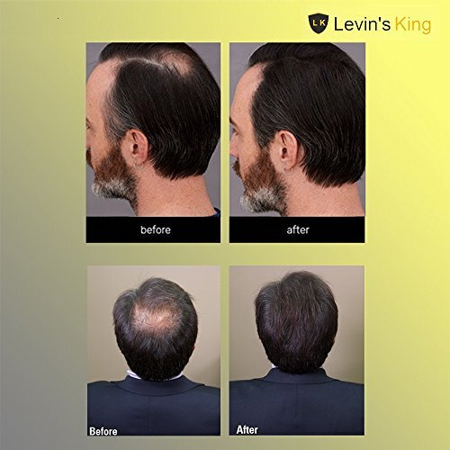 Levins King Hair Building Fiber, Concealer Refill Use For Toppik, Looks 21,Regrowth & All Other Hair Fiber Etc. (Black 25+25+25G) Pack Of 3