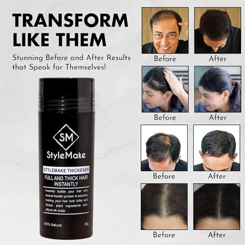 Stylemake Thickener Hair Loss Concealer | Transform Thin, And Fine Hair With Hair Building Fibre | Hair Building Fibers For Men And Women (Black) | Completely Undetectable, 28 Grams