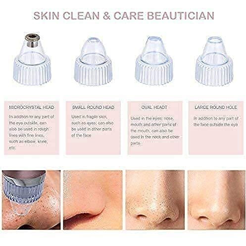 Blackhead Remover, Beautiful Skin Care Expert Acne Pore Cleaner Vacuum Blackhead Remover Kit Skin Cleaner, Pimple Removal Tool, 4 In 1 Multi-Function Blackheads (White-1)