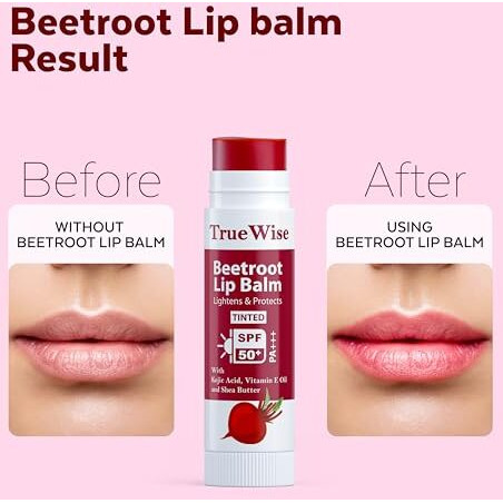 Truewise Tinted Lip Balm With Spf 50 Pa+++ Brightening Beetroot Lip Balm For Dark Lips With Kojic Acid,Vitamin E, Soft, Glossy Lips- Spf Lip Balm For Women 5G