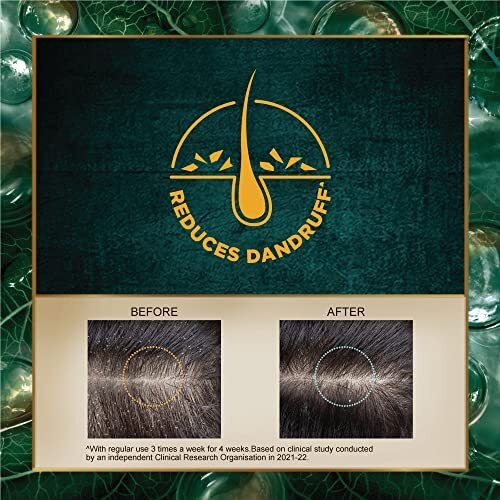 Indulekha Dandruff Treatment Shampoo 580 Ml