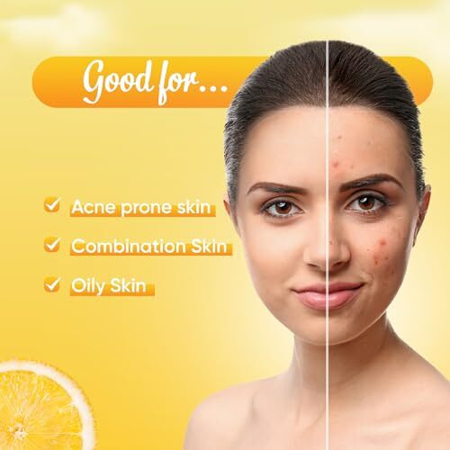 Ozone Acne Check Face Wash | Enriched With Aloe Vera, Lemon & Turmeric | For Oily Skin, Pimples, Acne Prone, Flawless & Glowing Skin | For Men & Women | 100Gm