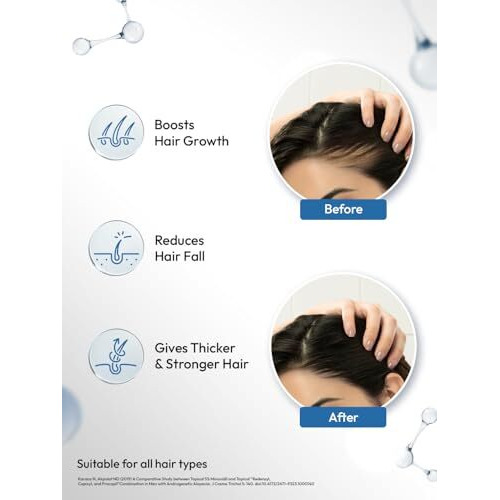 Scalpe Pro Hair Growth Serum With Applicator | 3% Redensyl, 4% Capixyl, 3% Procapil, 3% Anagain | Boosts Hair Growth | Thicker & Stronger Hair | Non-Sticky | Paraben & Sulphate-Free | Unisex | 30 Ml